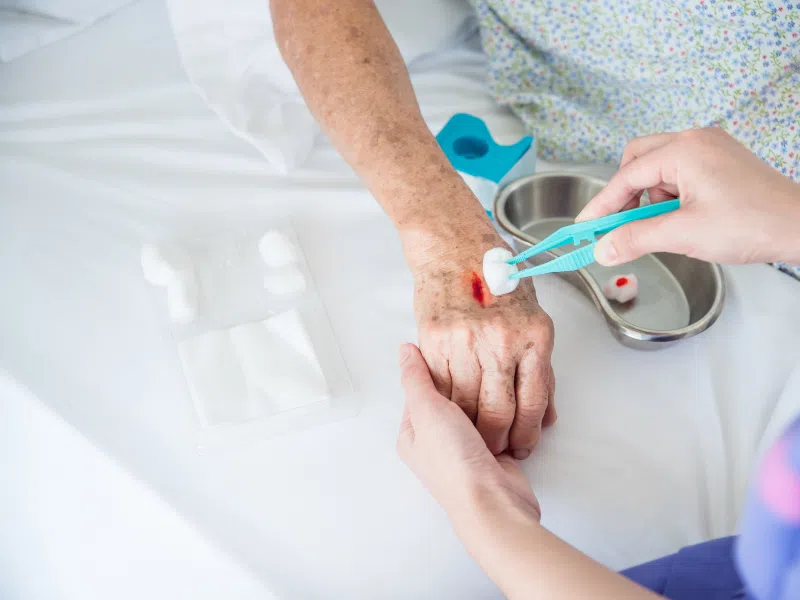 GP providing wound care and dressing services - Belconnen General Practice