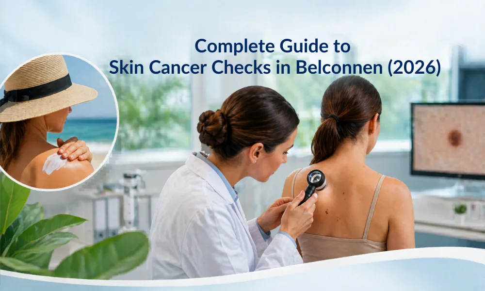 Complete Guide to Skin Cancer Checks in Belconnen 2026
