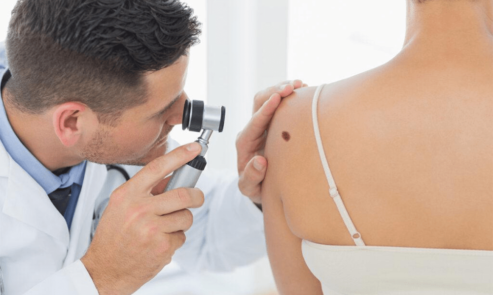 Complete Guide to Skin Cancer Checks in Belconnen (2026) 1