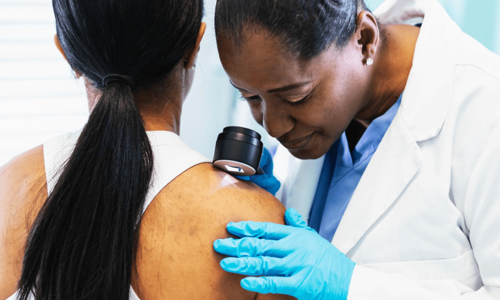 Complete Guide to Skin Cancer Checks in Belconnen (2026) 5