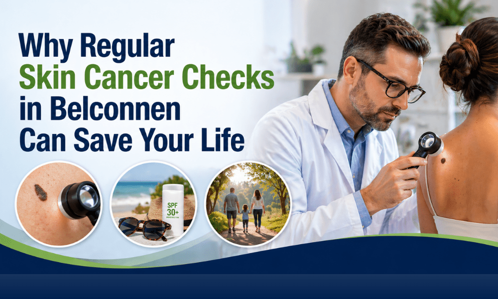 Why Regular Skin Cancer Checks in Belconnen Can Save Your Life